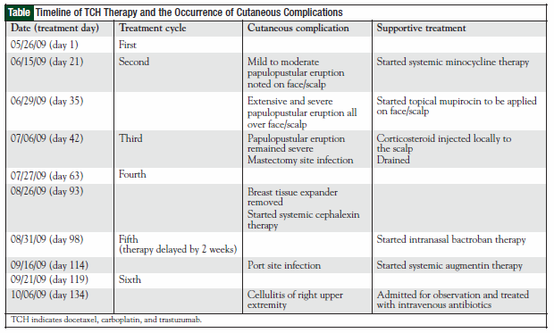 Table Major Trials for Carcinoid Tumors and Pancreatic Neuroendocrine Tumors